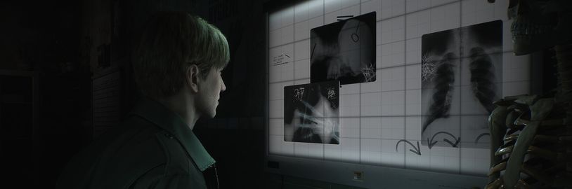 Remake Silent Hillu 2 má být po obsahové stránce hotov